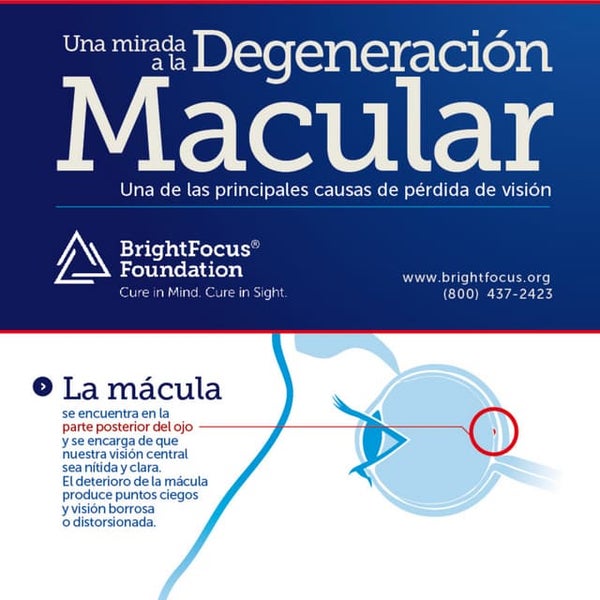 A Look At Macular Degeneration Infographic