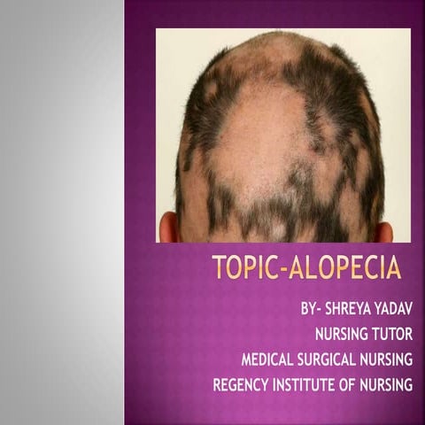 Alopecia.pptx