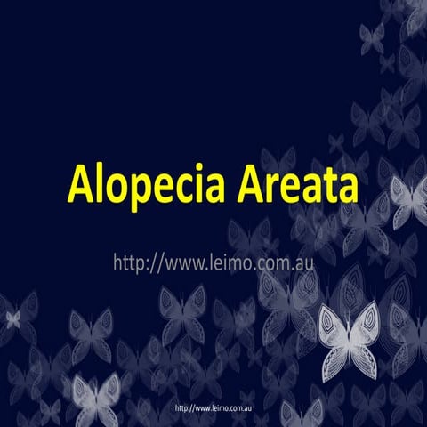 Alopecia areata