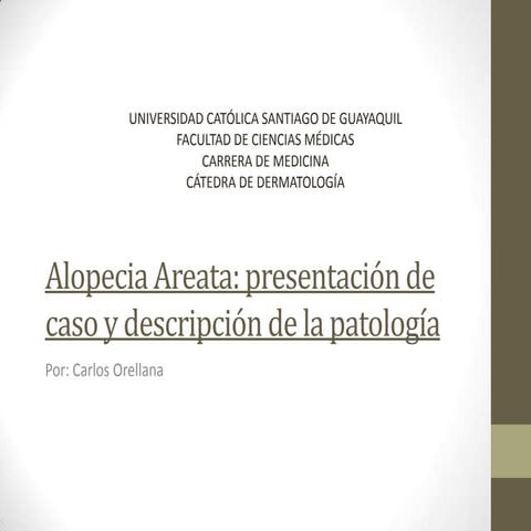 Alopecia areata