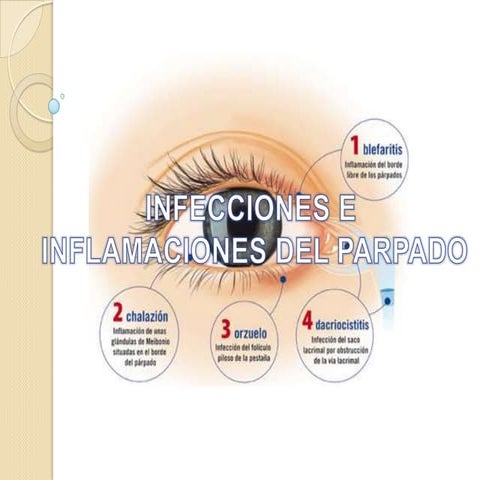 Alteraciones del parpado y conjuntiva