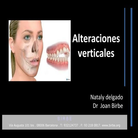 Alteraciones verticales