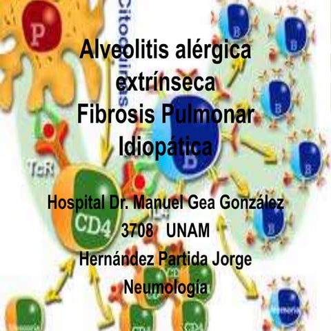 Alveolitis alérgica extrínseca  gea