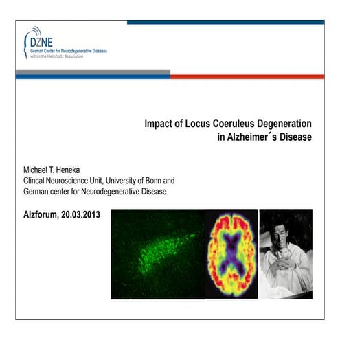 Alzforum webinar m heneka 20 03 2013