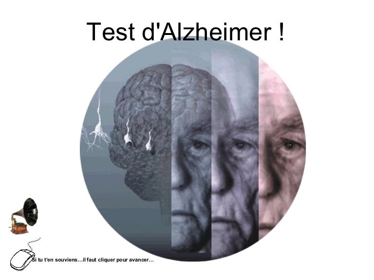 Тест на болезнь альцгеймера сколько лиц вы видите на картинке