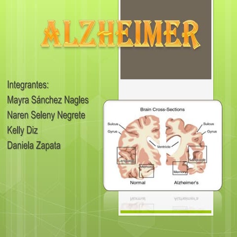 Alzheimer 