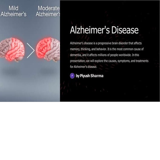 Alzheimers-Disease.pptx