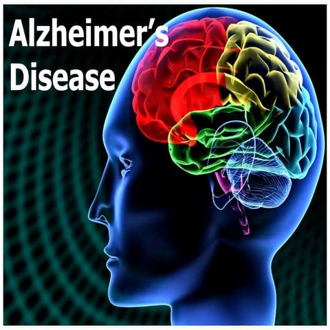 Alzheimer’s disease: Management