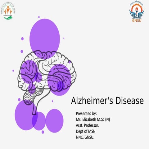Alzheimer's disease