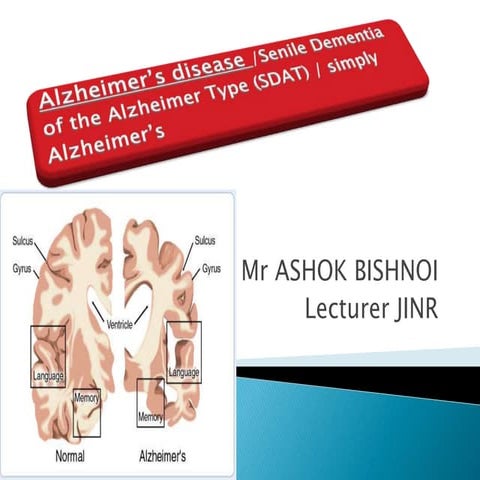 ppt on Alzheimer’s disease 