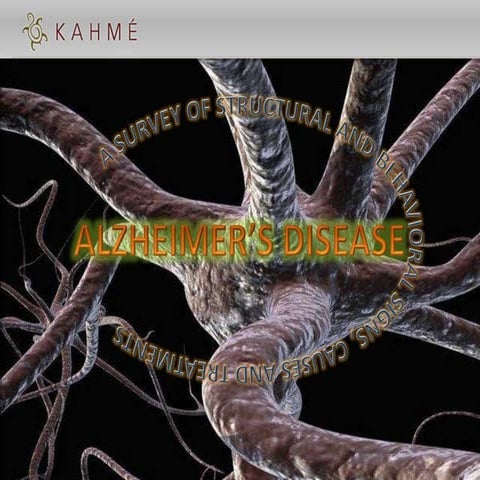 Alzheimers Causes and Treatments