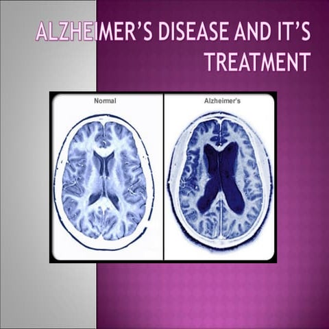 Classification and mechanism of action of alzheimers drugs | PPTX