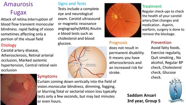 Amaurosis fugax | PPT