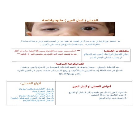الغمش  او كسل العين.docx