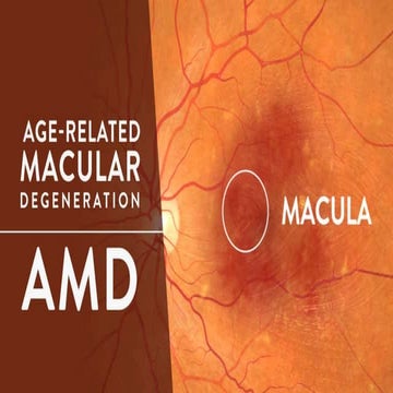 AMD | PPTX