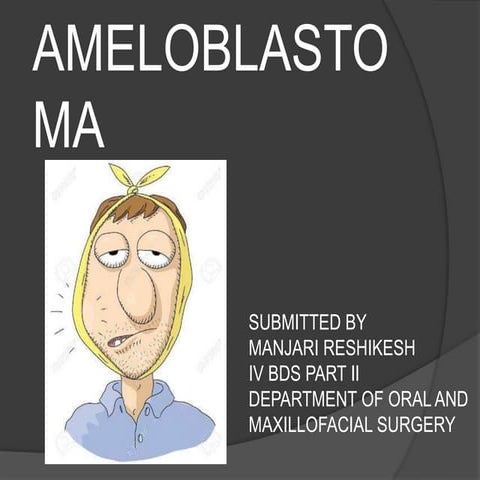 Ameloblastoma