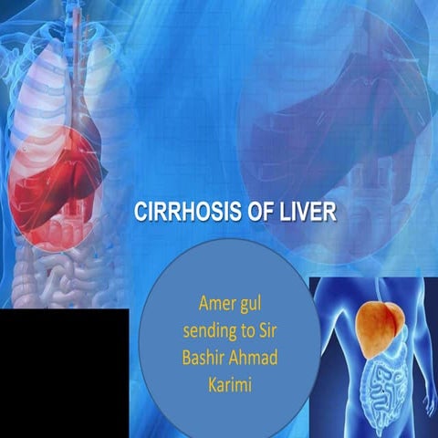 Amer cerrhosis of liver
