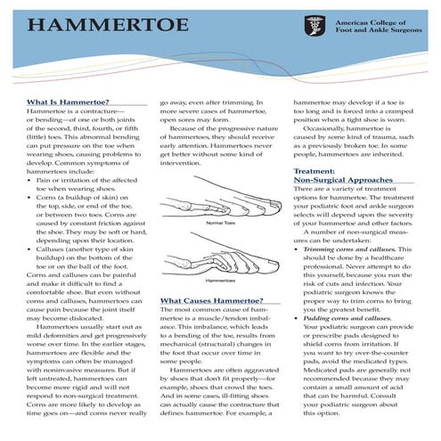 Hammer Toes: Causes, Symptoms and Treatments