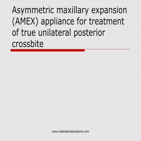  Asymmetric maxillary expansion (AMEX) appliance for treatment of true unilat...