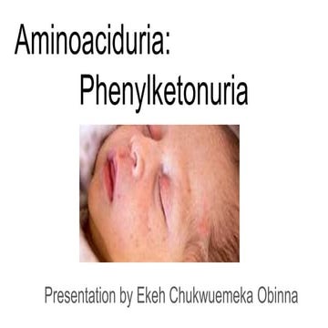 Aminoaciduria  phenylketonuria