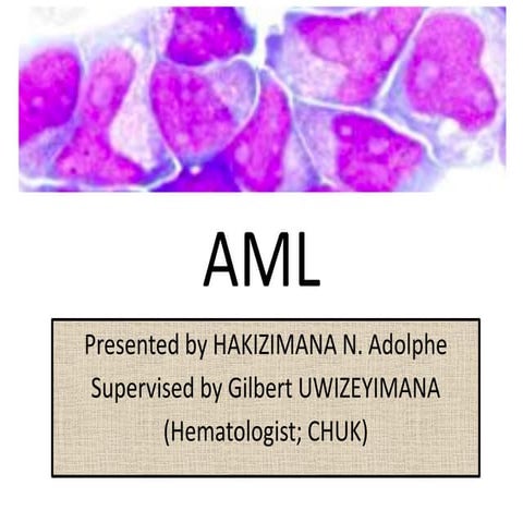 Acute myeloid leukemia | PPTX