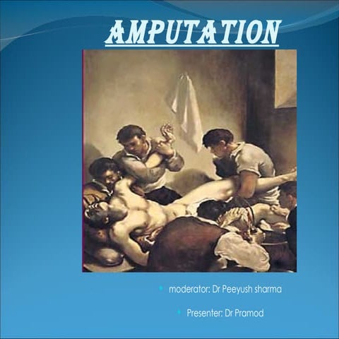 Amputation.Dr Pramod