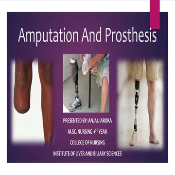 Amputation and prosthesis  