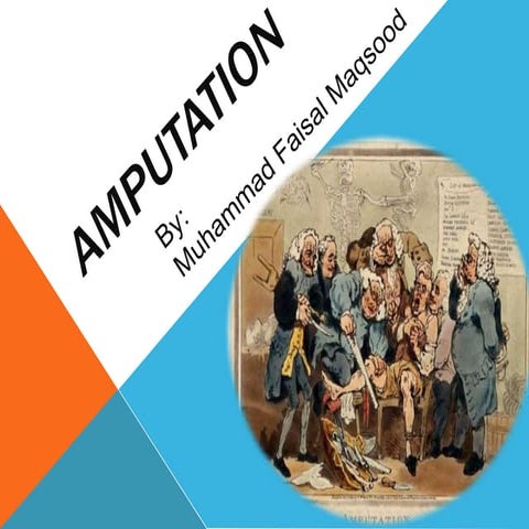 amputations.pptx