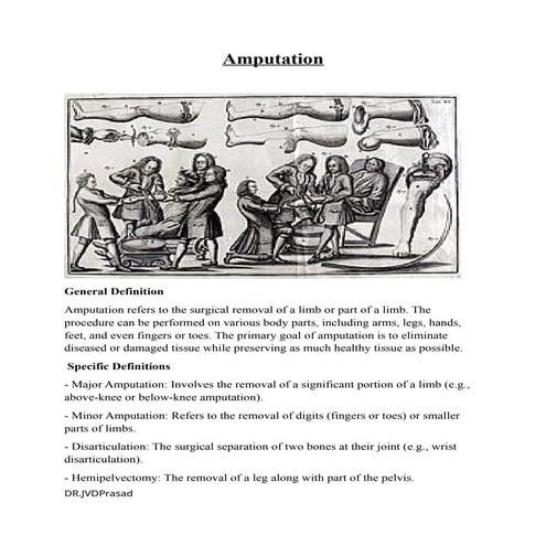 AMPUTATIONS- Definition, Types, procedures, indications