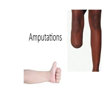 Amputations, types and levels , orthotics and prosthetics