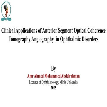 clinical application of OCT-A in anterior segment of the eye | PPTX