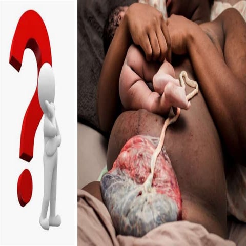 Active Management of Third Stage of Labour