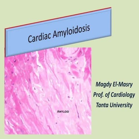 Cardiac Amyloidosis 