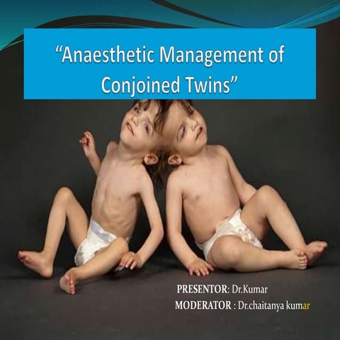 Anaesthetic management of conjoined twins’