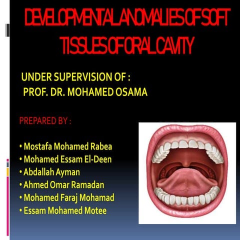 anamolies of soft tissues of oral cavity.pptx