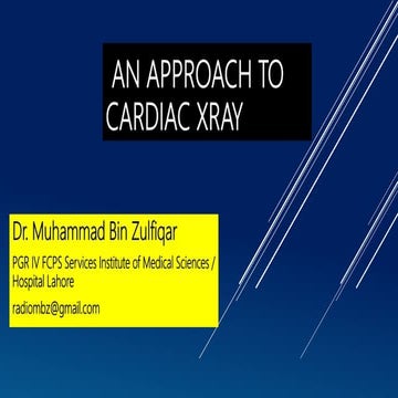 An approach to cardiac xray Dr. Muhammad Bin Zulfiqar