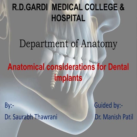 Anatomical considerations for dental implants