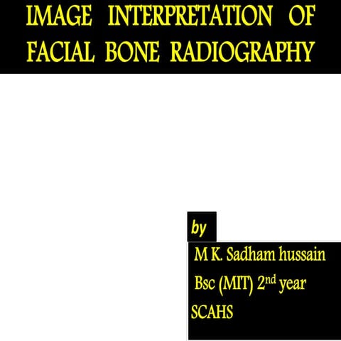 Anatomy and image interpretation of facial bone