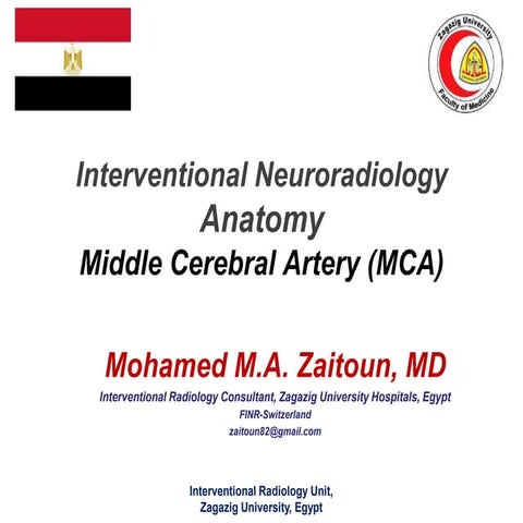 Anatomy of the middle cerebral artery (MCA)