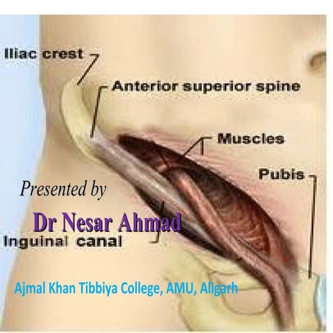 Anatomy of inguinal canal -  Dr nesar Ahmad