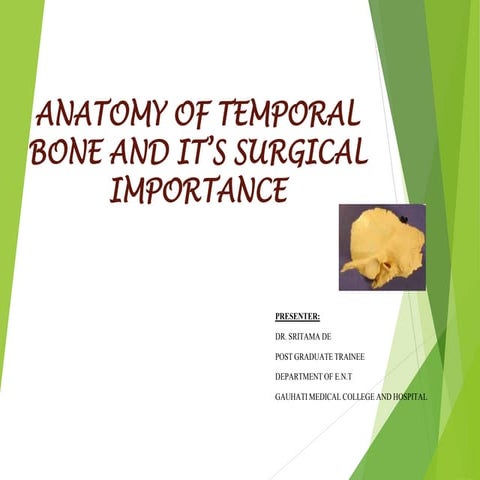 Anatomy of temporal bone and it’s surgical importance