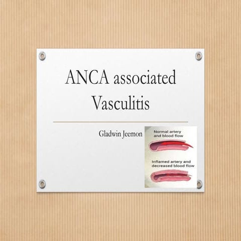 Anca associated vasculitis new