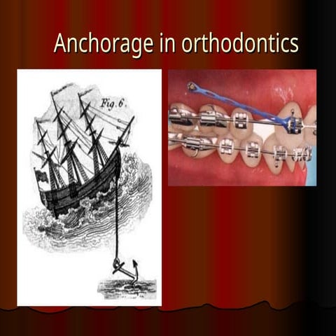 Anchorage in Orthodontics | PPTX