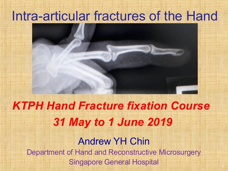 Hand Intra Articular Fractures