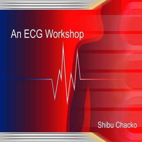 An ECG workshop