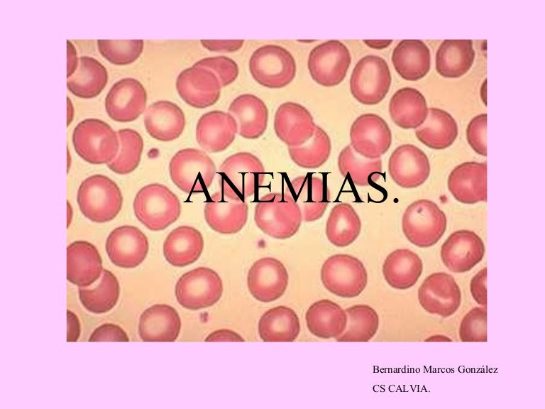 microcitosis leve sintomas de diabetes