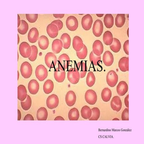 Anemia