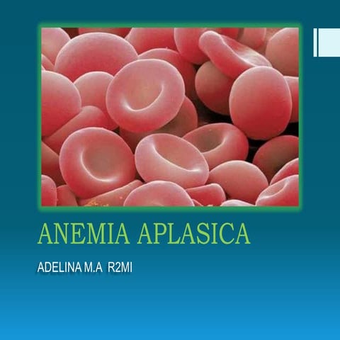 Anemia aplasica