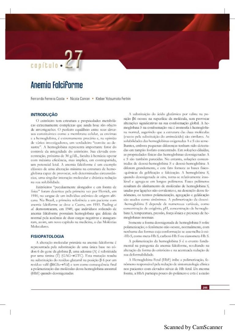 Anemia Falciforme anemia falciforme