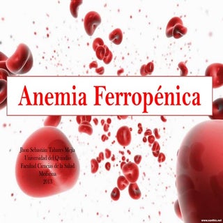 Anemia Ferropenica